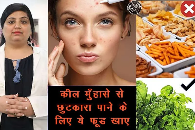 Acne Diet