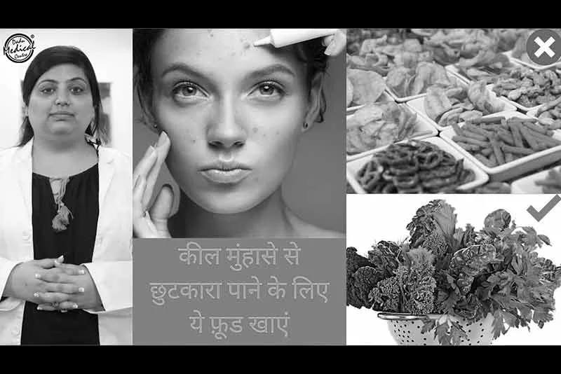 Acne Diet Guide | Food items that can help you prevent Acne- Dermatologist Approved