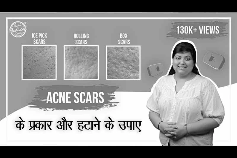 The Most Effective Acne Scars Treatment | Acne Scar Removal | Types of Acne Scars | Dr Nivedita Dadu