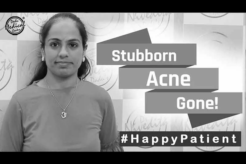 स्टबबर्न एक्ने ट्रीटमेंट | Stubborn Acne Treatment | Dr. Nivedita Dadu's Dermatology Clinic