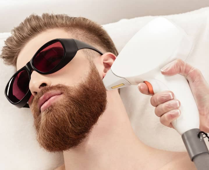 Laser Beard Shaping Clinic in Delhi