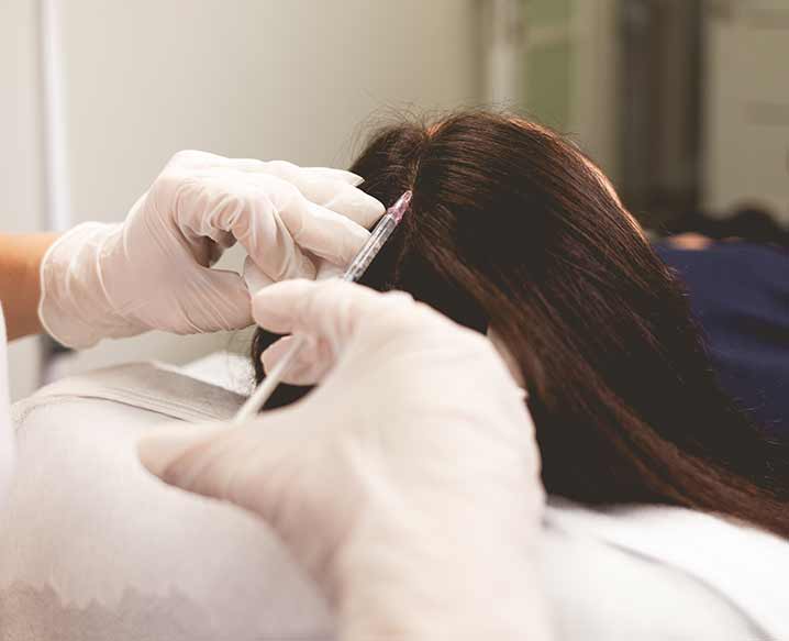 Mesotherapy for Hair Fall Treatment in Delhi