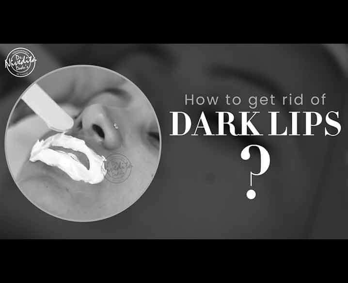 Dark Lips